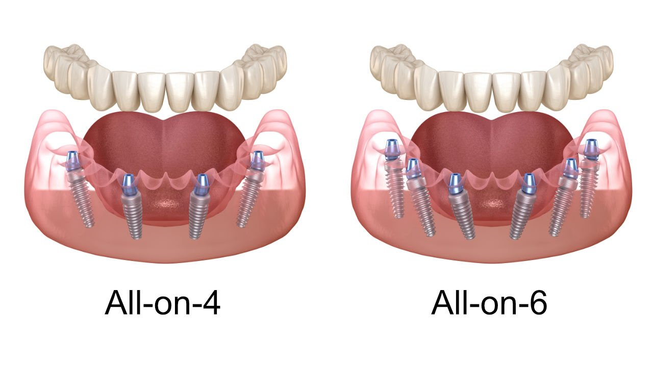8b063a4af5e8150930815254a5eef3ec.png 8b063a4af5e8150930815254a5eef3ec.png