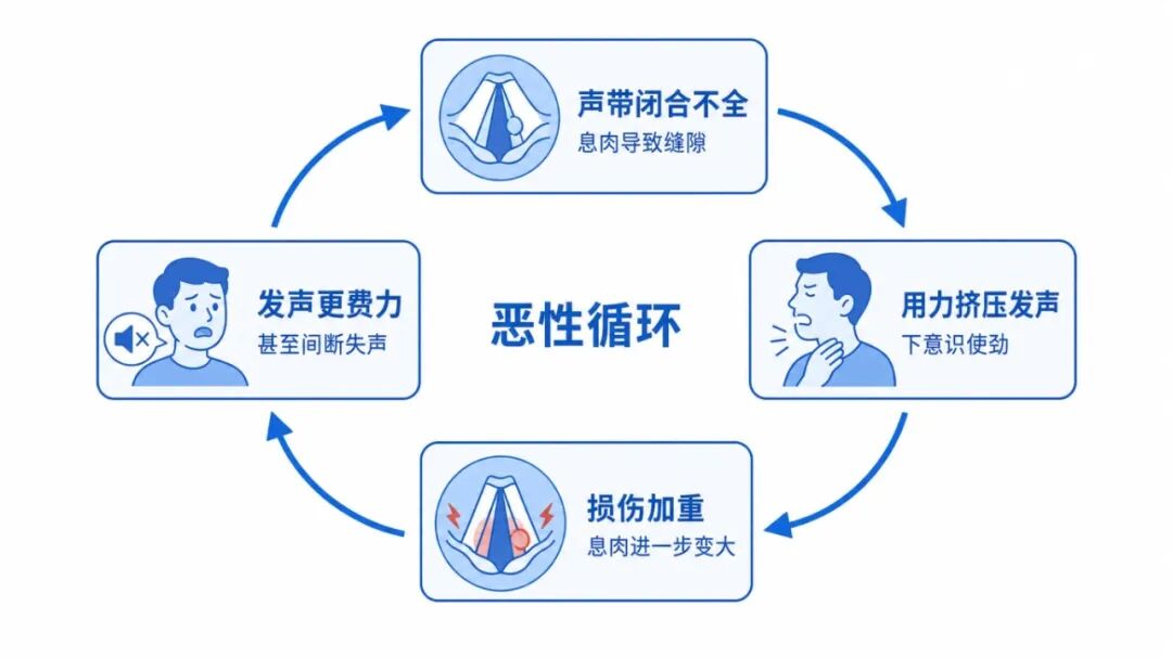 恶性循环声带科普图.jpg 恶性循环声带科普图.jpg